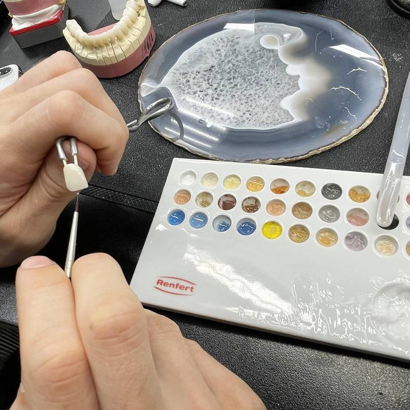 Зубной техник: зарплата, что делает, как им стать и где учиться