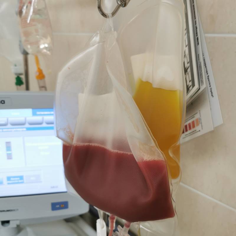 Вот так вот выглядит лейкоцитарная масса — бурая и плазма крови — желтая. В итоге у меня взяли 420&nbsp;мл лейкоцитарной массы и 300&nbsp;мл плазмы крови