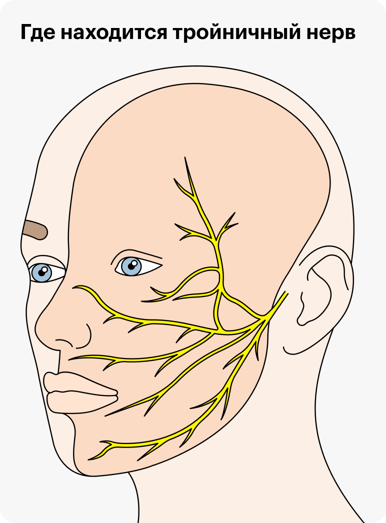 Где находится тройничный нерв на лице крупный рисунок