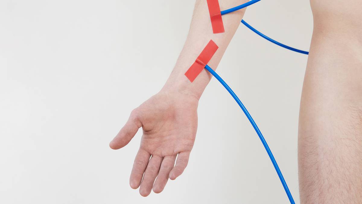 Что такое гемодиализ и зачем он нужен