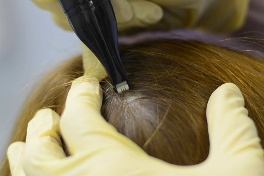 Что такое трихограмма волос и стоит ли ее делать