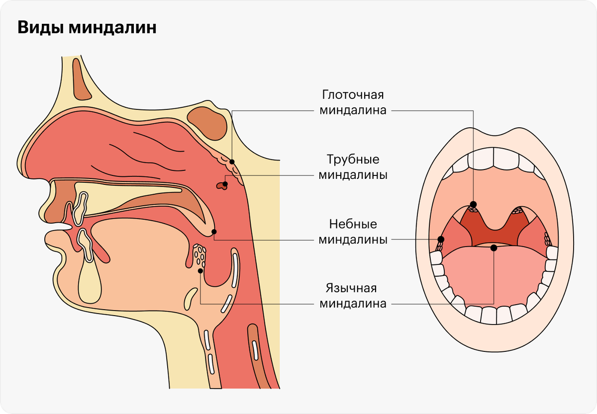 Миндалины схема расположение