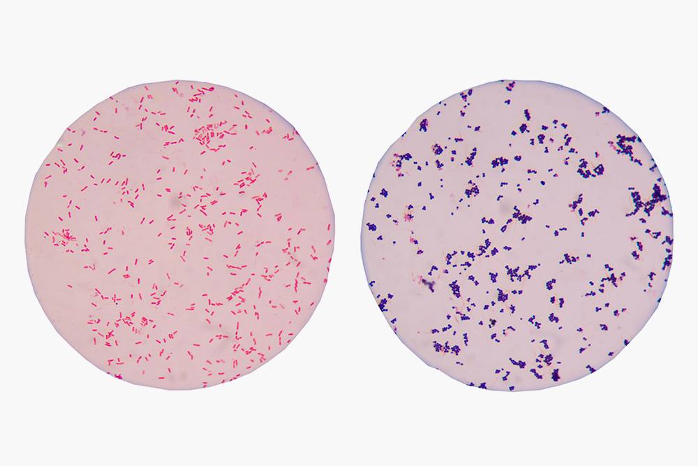 Так выглядят под&nbsp;микроскопом окрашенные по Граму бактерии. Слева — грамотрицательные, справа — грамположительные. Источник: Schira / Shutterstock