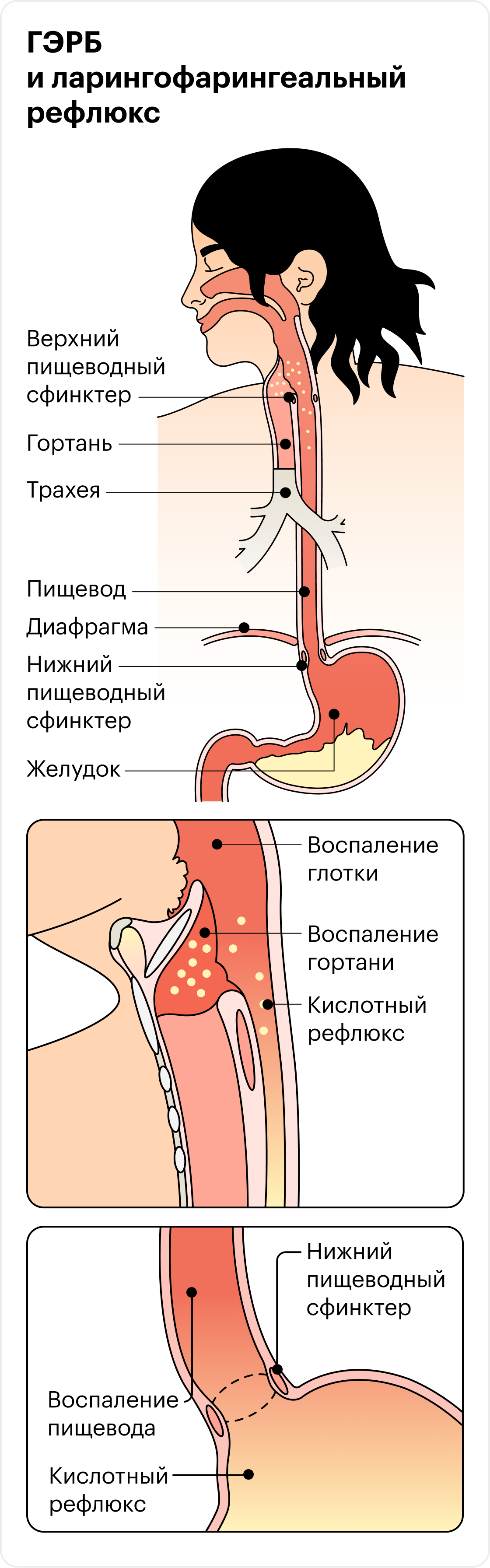 болит желудок после минета фото 106