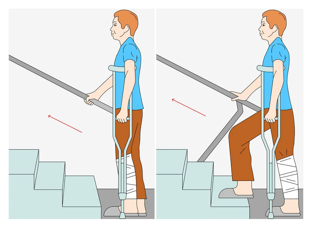 Подниматься спускаться по лестнице. Ходьба на костылях по ступенькам. Лестница костыли. Техника ходьбы на костылях. Техника хождения на костылях по ступенькам.