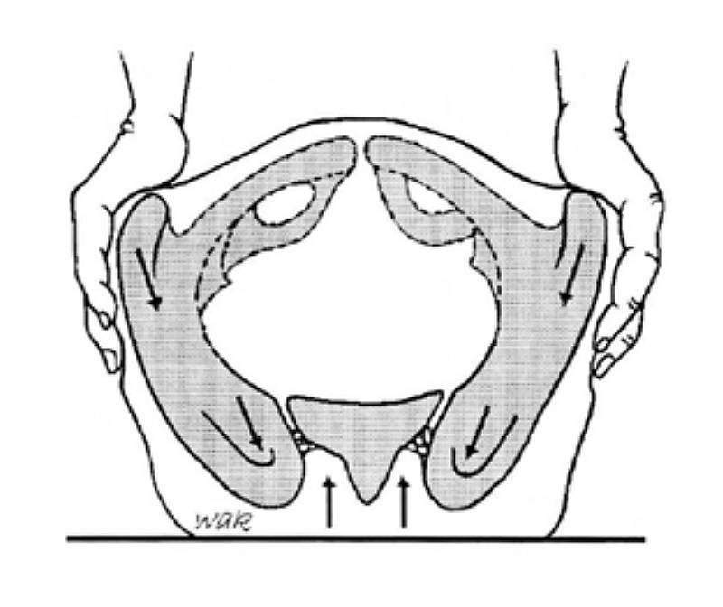 Так выглядит одна из диагностических методик: остеопат нажимает на таз, чтобы оценить, какое положение занимают составляющие его кости. Источник: Глоссарий остеопатической терминологии