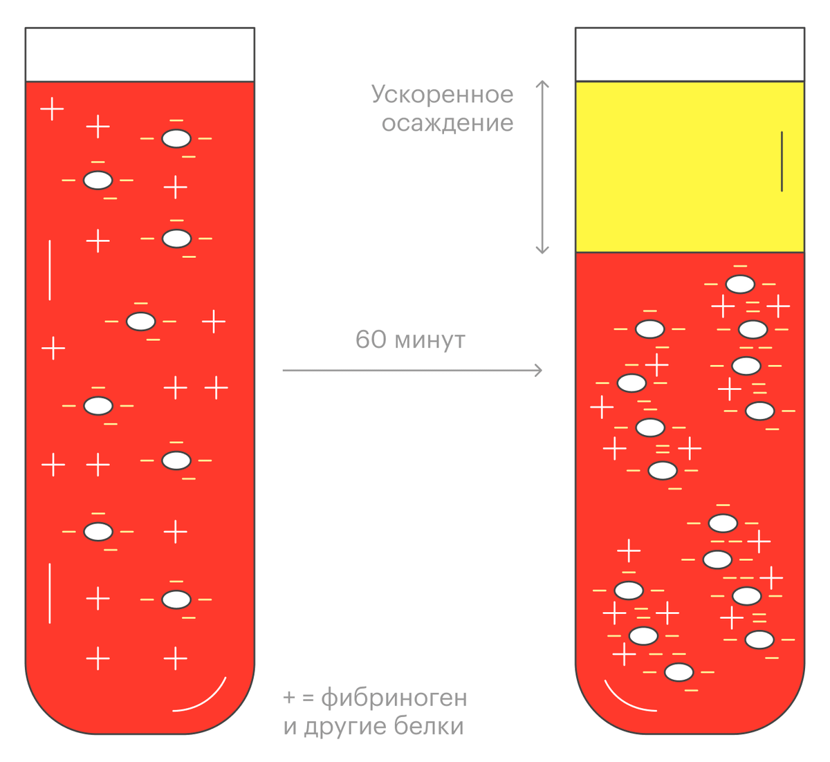 СОЭ: норма у мужчин и женщин, расшифровка анализа крови, повышенные и ...