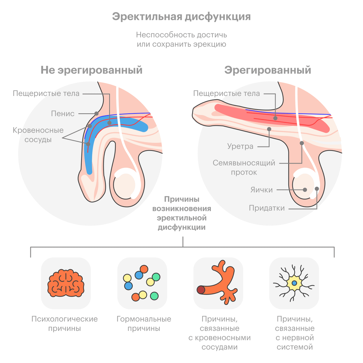 Эректильная дисфункция картинки