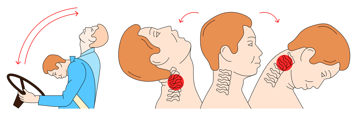 Травмы шеи картинки