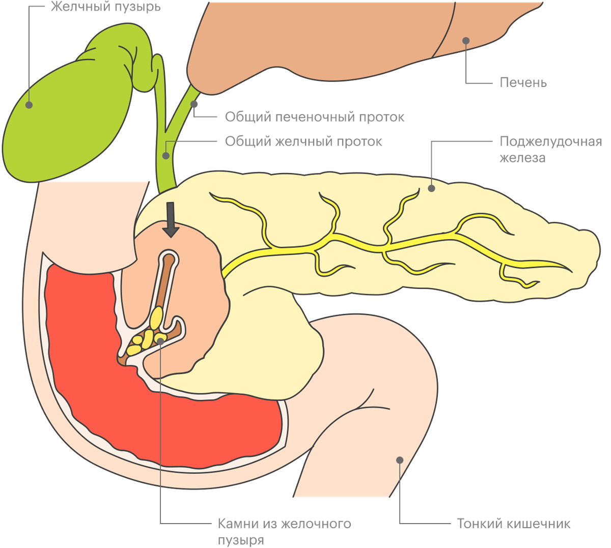 Желчный пузырь и поджелудочная железа анализы. Санториниев проток поджелудочной железы. Желчные протоки и протоки поджелудочной железы. Вирсунгов проток поджелудочной железы.