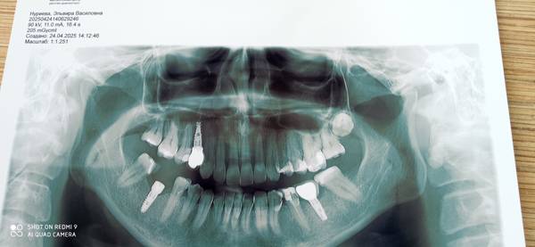 Эльвира Нуриева