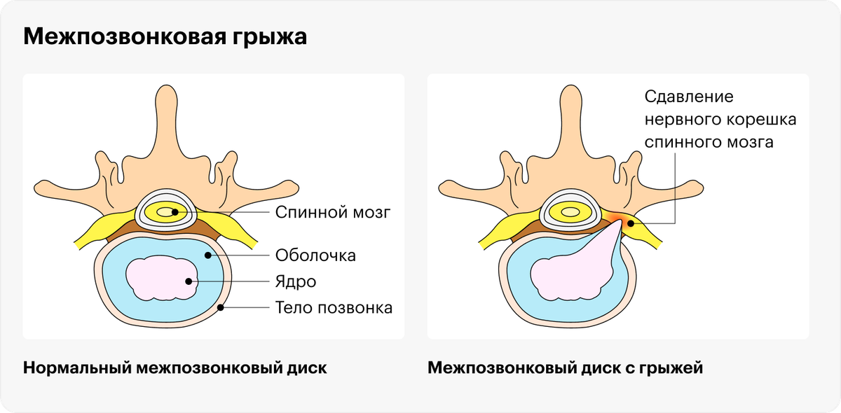 Продукты для мягкого стула у взрослого после операции