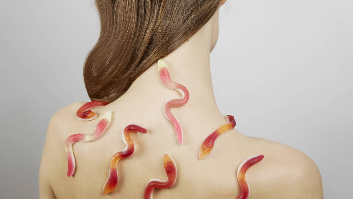 Гирудотерапия: показания и противопоказания к лечению пиявками, эффект ...