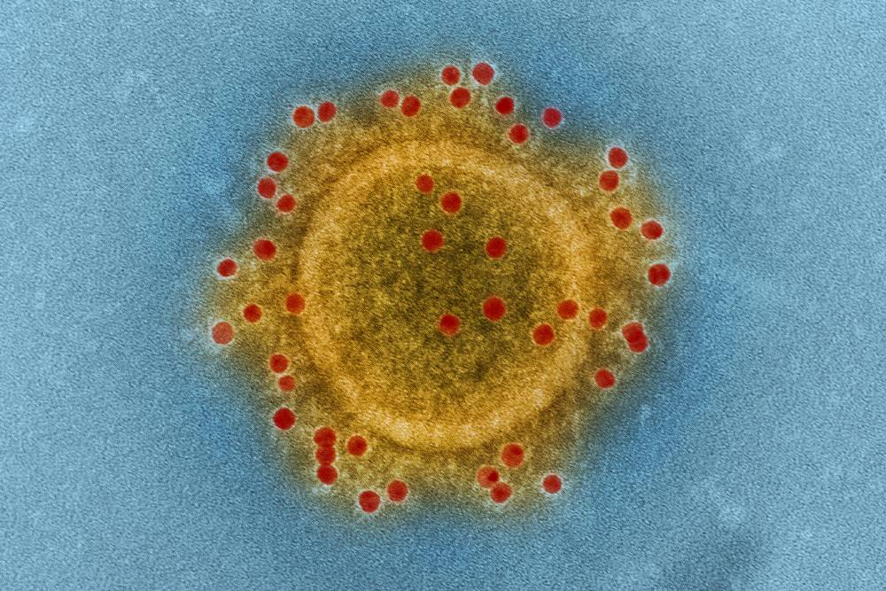 Вирус MERS похож на своего родственника SARS. Источник:&nbsp;wikimedia.org