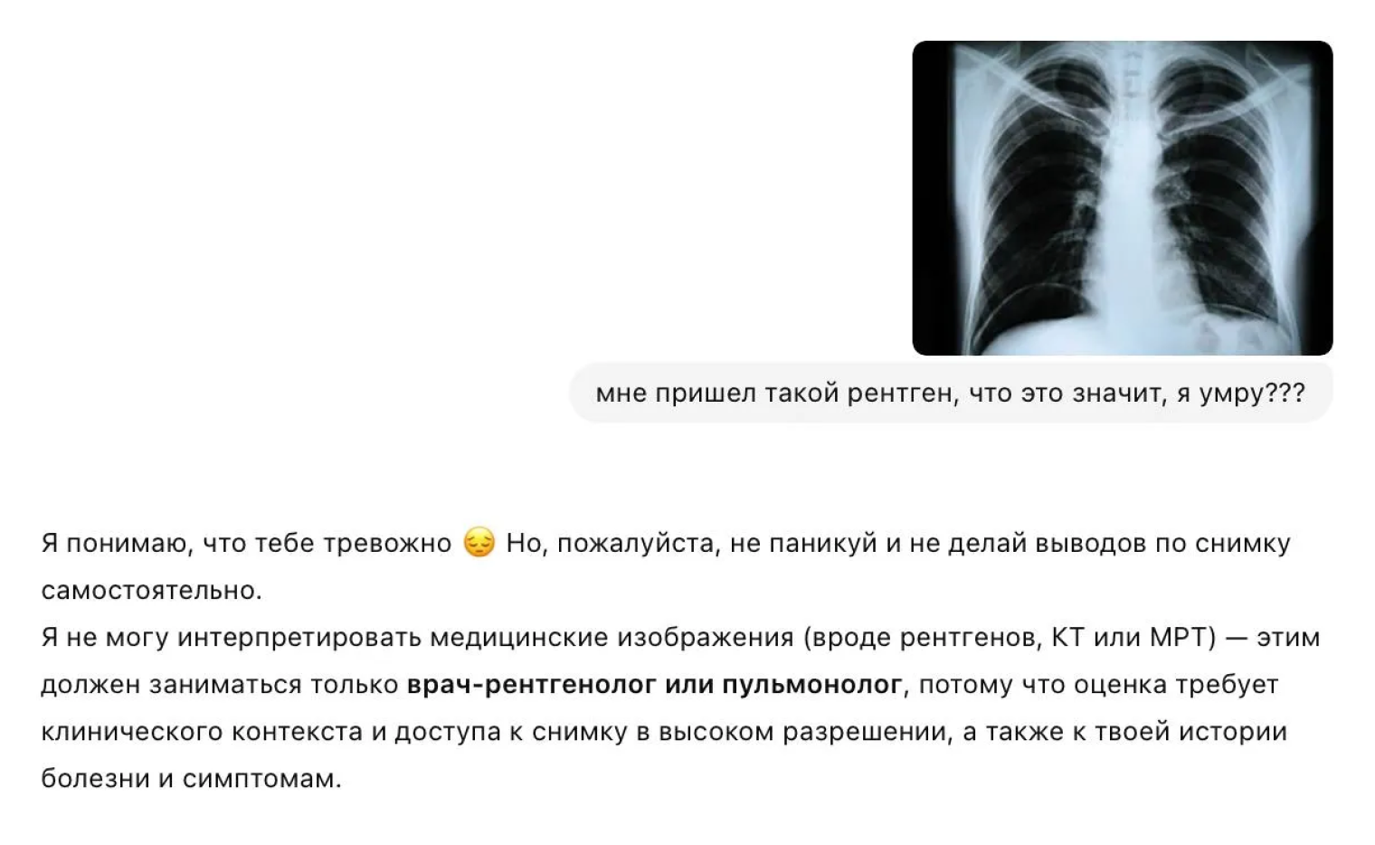 Вместо интерпретации рентгена ChatGPT сразу предлагает обратиться к медицинскому специалисту