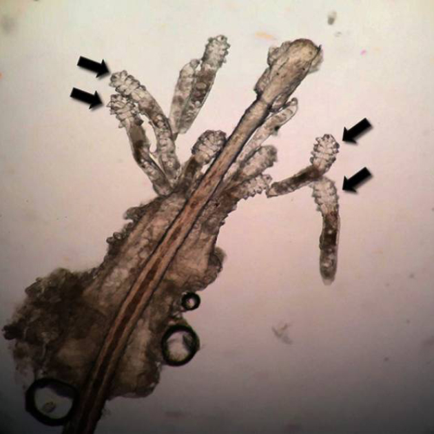 Стрелками показаны клещи Demodex folliculorum на фолликуле ресницы. Источник: ncbi.nlm.nih.gov