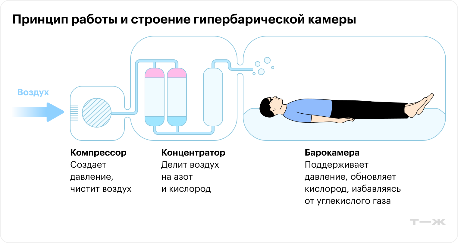 При гипербарической оксигенации пациента помещают в барокамеру, где он дышит чистым кислородом под повышенным давлением