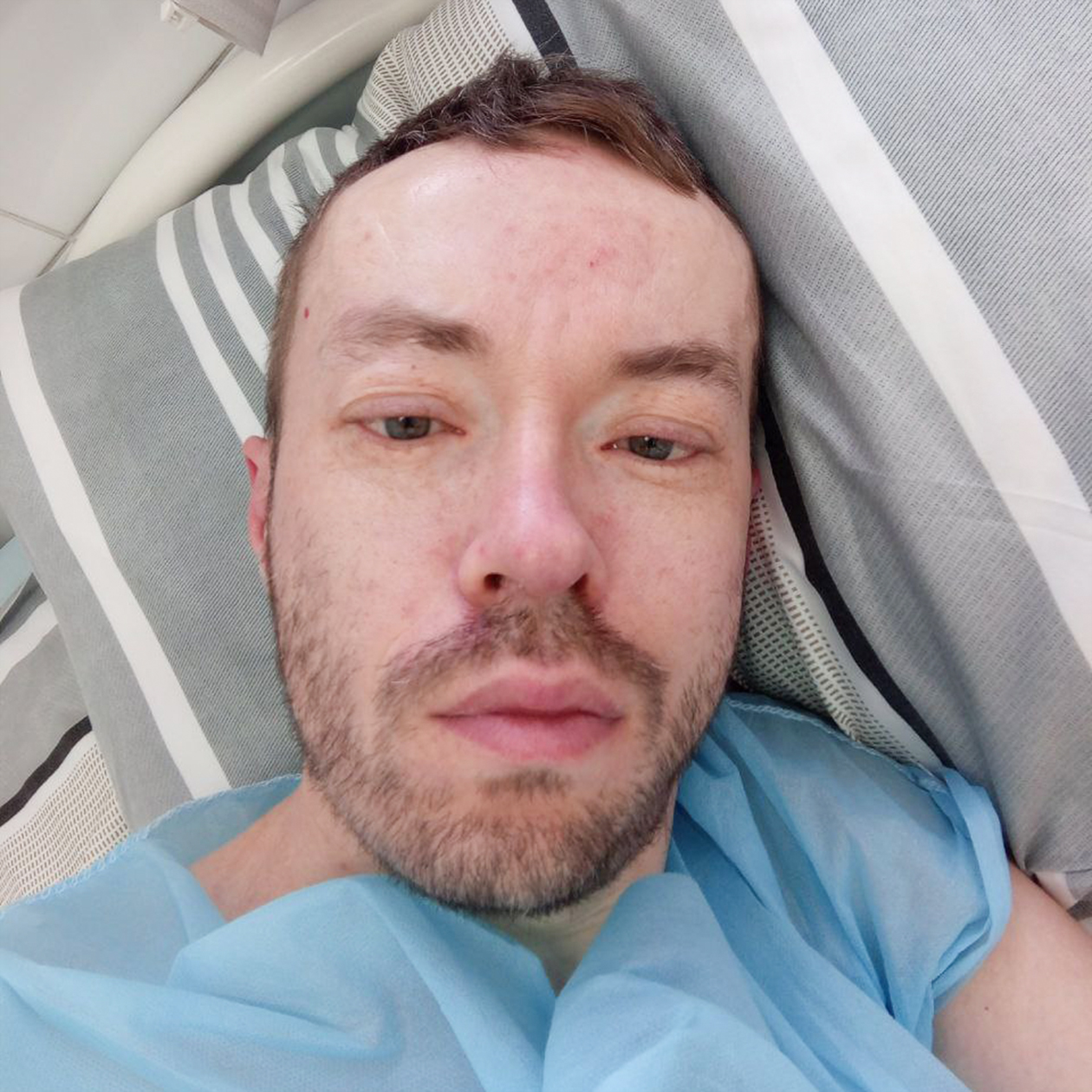 Первое селфи сразу после операции