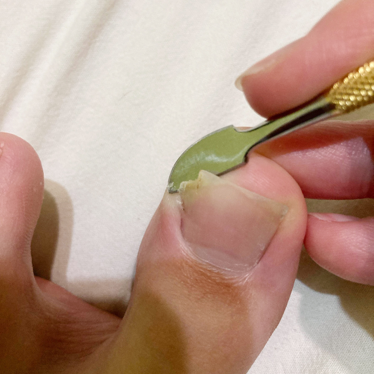 Так выглядел край ногтя