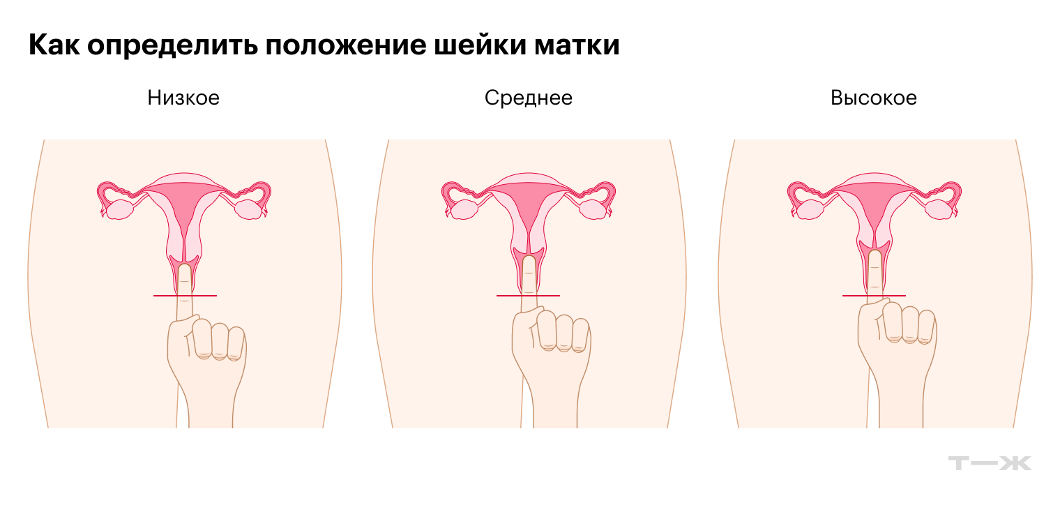 Если достать до шейки не получается или удается только при полностью введенном пальце — она высоко, подойдут чаши длиной от 54 мм. Если вы нащупали шейку, введя палец наполовину или на две трети — она на среднем уровне, подойдут чаши длиной 45—54 мм. Если шейка прощупывается сразу, стоит ввести палец лишь на треть, — она низко, лучше выбирать чаши длиной до 45 мм