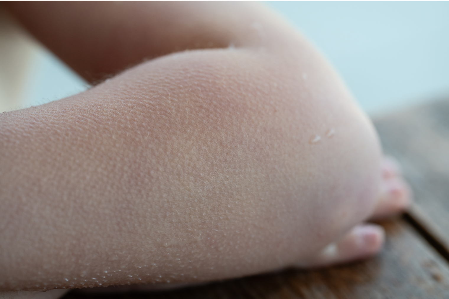 Гусиная кожа на руках. Фотография: E.Rous / Shutterstock / FOTODOM