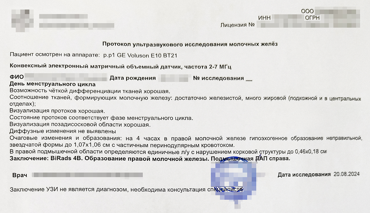 Заключение УЗИ, во время которого в груди нашли опухоль