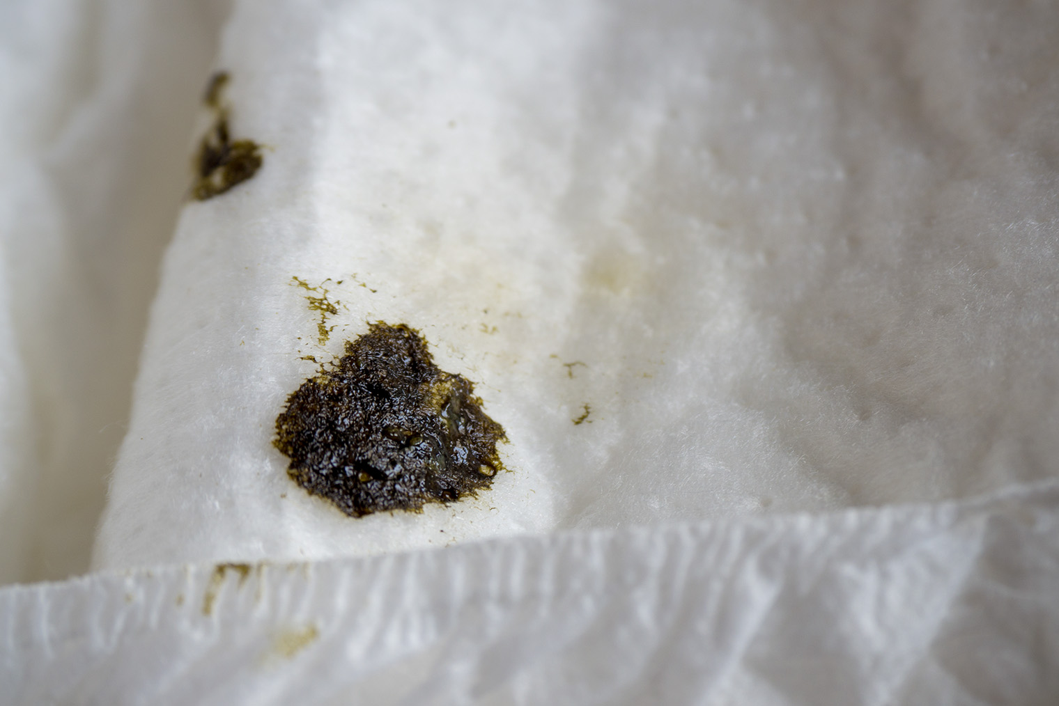 Стул черного цвета вязкий, липкий и отмывается сложнее, чем обычный. Некоторые родители сравнивают его с гудроном и мазутом. © Prot Tachapanit / iStock