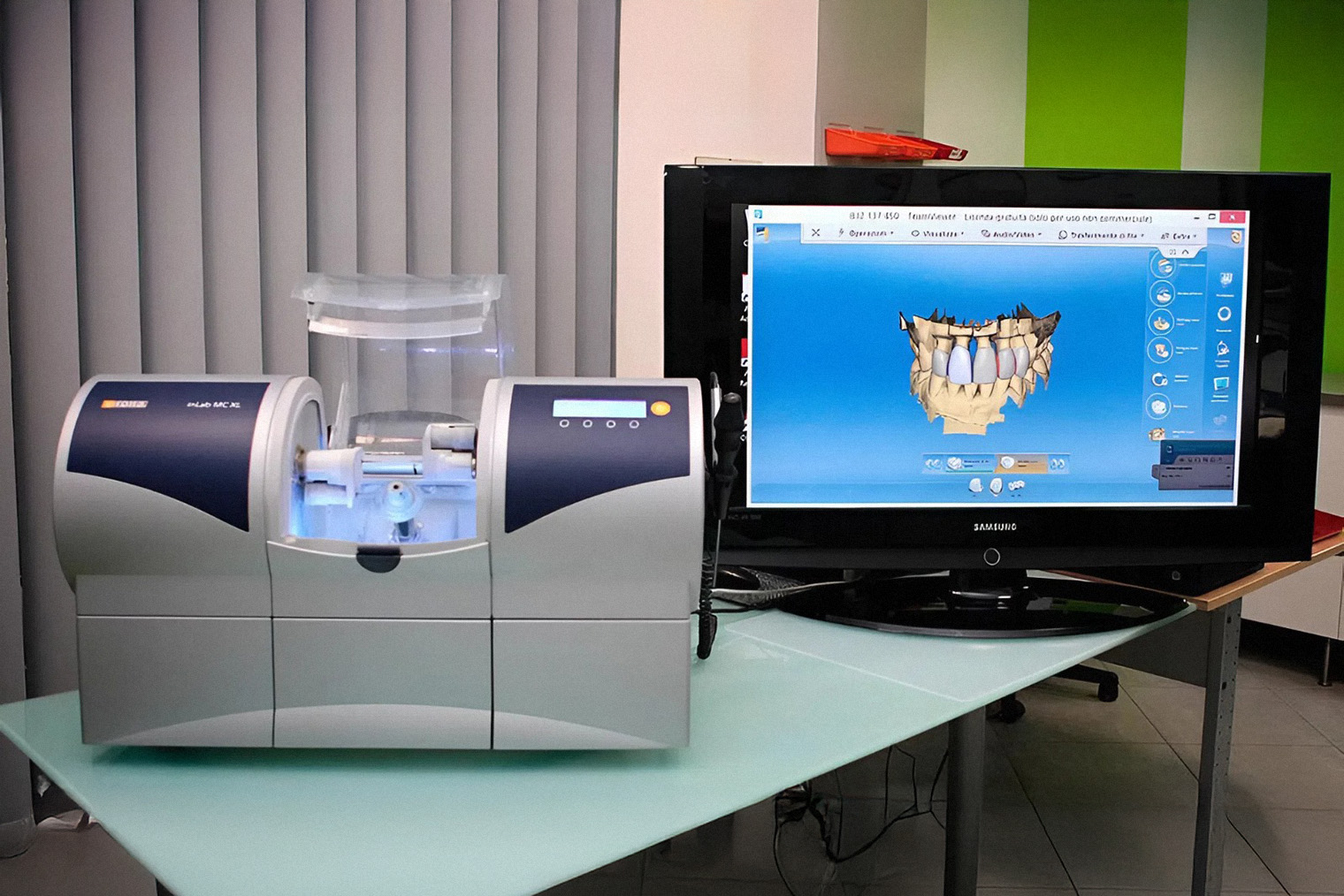 Применение CAD/CAM-технологий при работе на на имплантах. Источник: mednav.ru