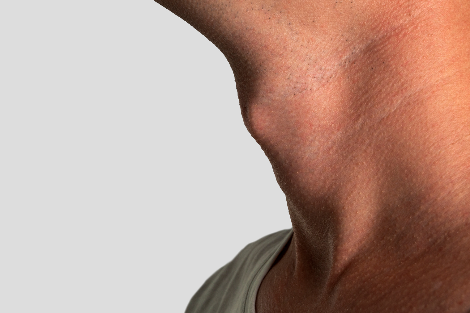 Так выглядит кадык — выступ на передней поверхности шеи, часть гортани. Фотография: daniiD / Shutterstock / FOTODOM
