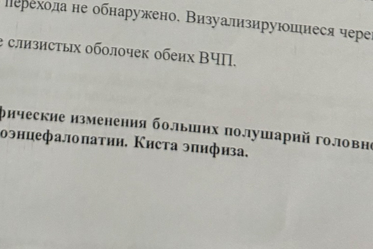 По крайней мере теперь знаю, откуда у меня головные боли