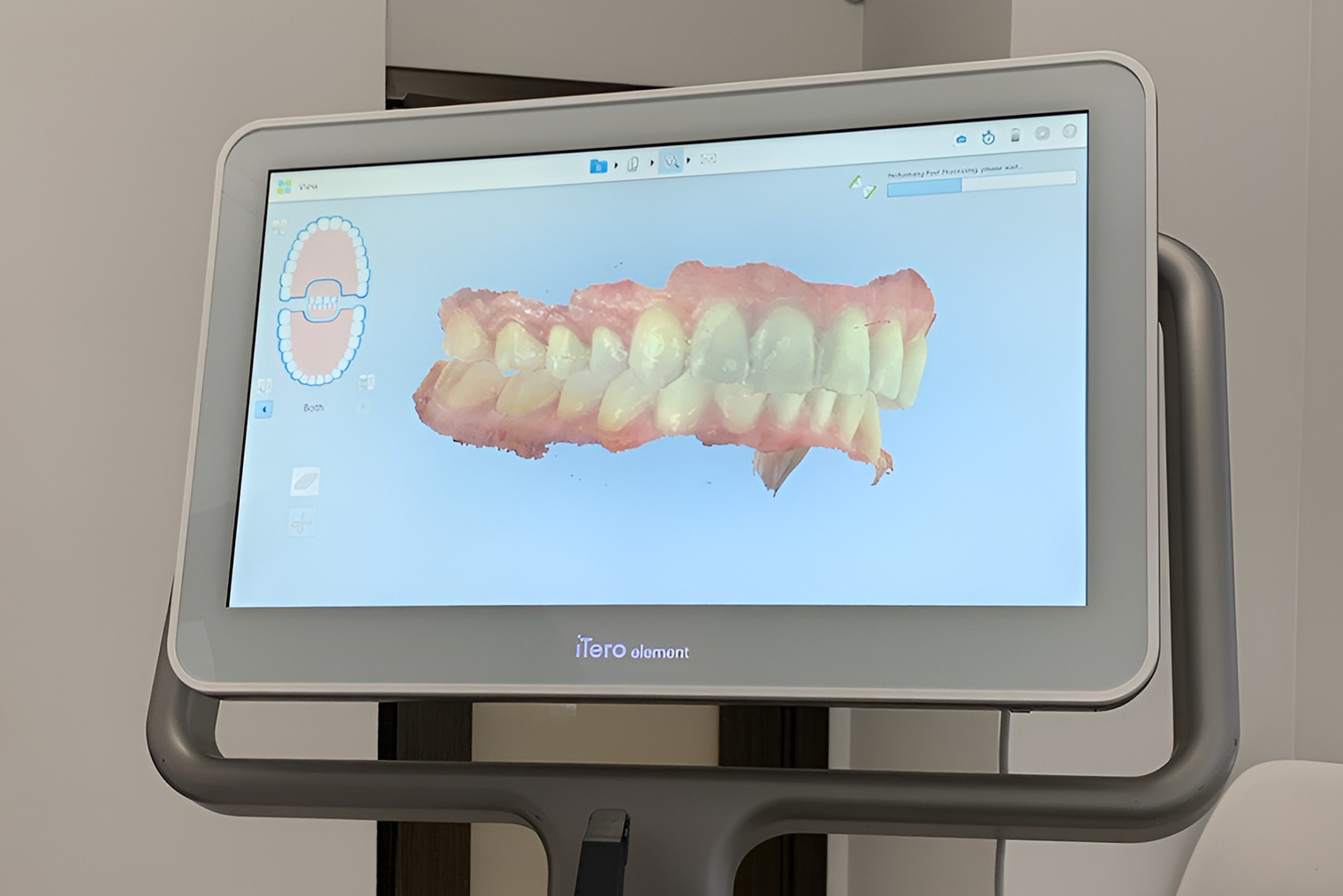 Так выглядит 3D⁠-⁠модель зубов. Врач может вращать ее на экране прикосновением пальцев
