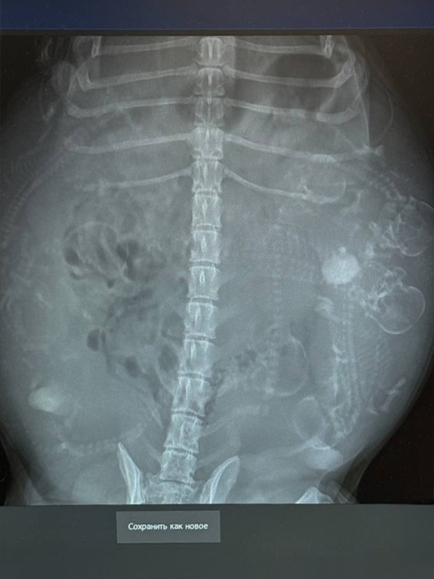 Это рентгеновский снимок собаки на 50-й день беременности. Напишите в комментариях, сколько щенков вам удалось сосчитать