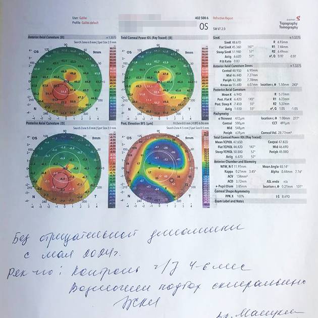 Последние результаты кератотопографии, за три месяца ухудшения не было