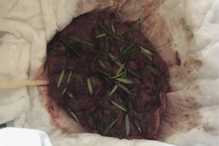 Как выглядит плацента после промывания. В этом случае родители поместили ее в тканевый мешочек и посыпали розмарином. Источник: journals.sagepub.com