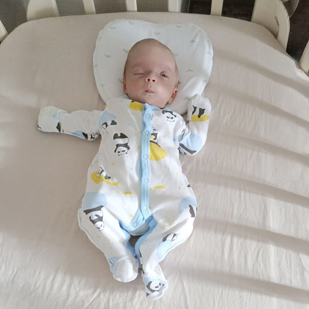 У малыша был сильно деформирован череп, один глаз не закрывался, а другой — не открывался