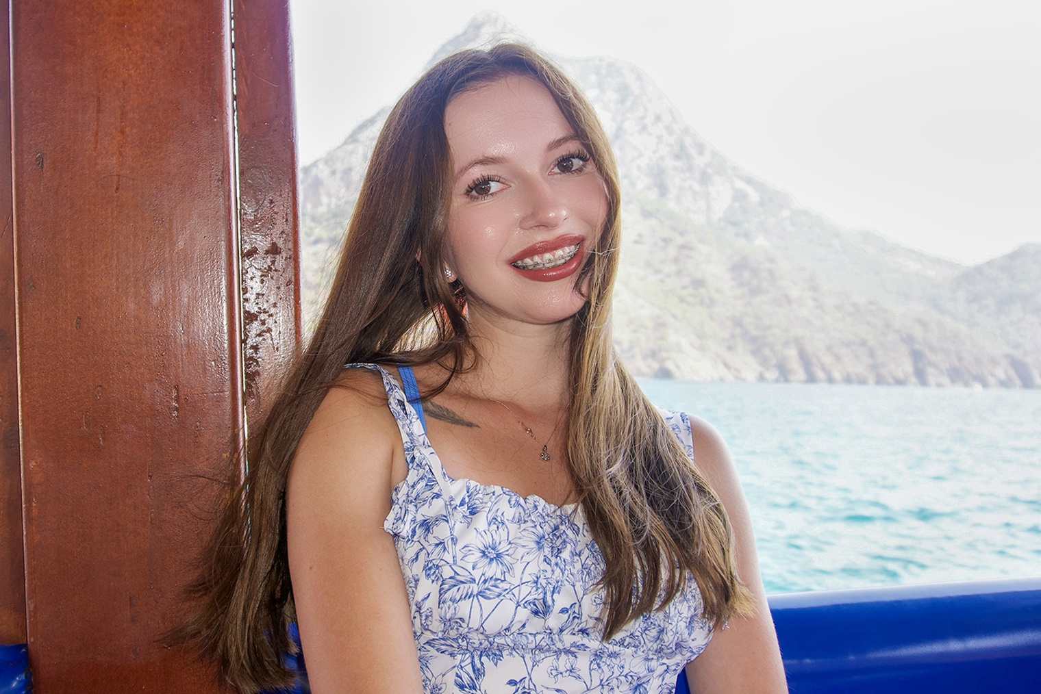 Так я выглядела в июле 2025 года. Улыбка стала гармоничной, осталось поправить кое-что с прикусом, и лечение будет завершено