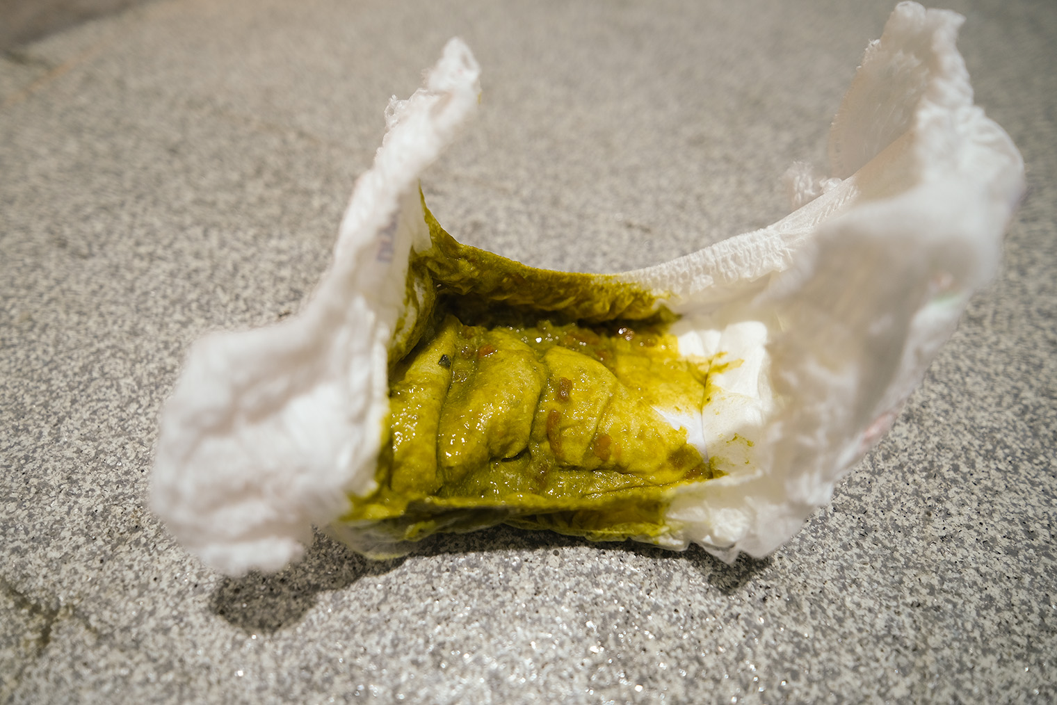 Как правило, зеленый стул более жидкий, чем желтый. © All_About_Najmi / iStock