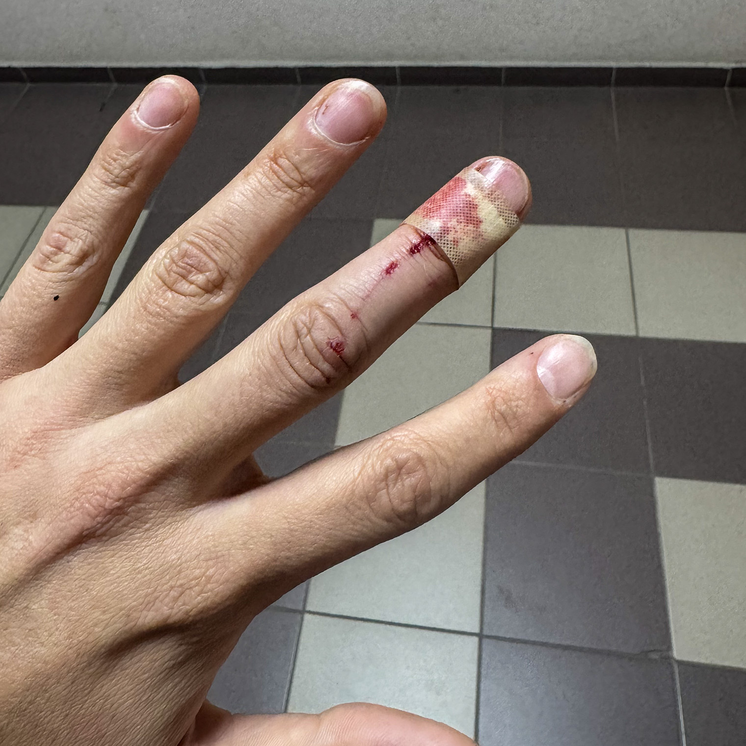 Цезарь укусил, когда я пытался надеть на него намордник