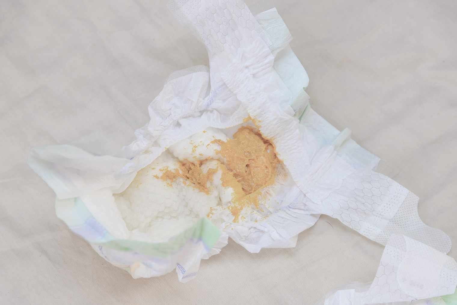 Консистенция белого стула может быть от кашицеобразной до твердой. © Vadi Fuoco / Shutterstock / FOTODOM