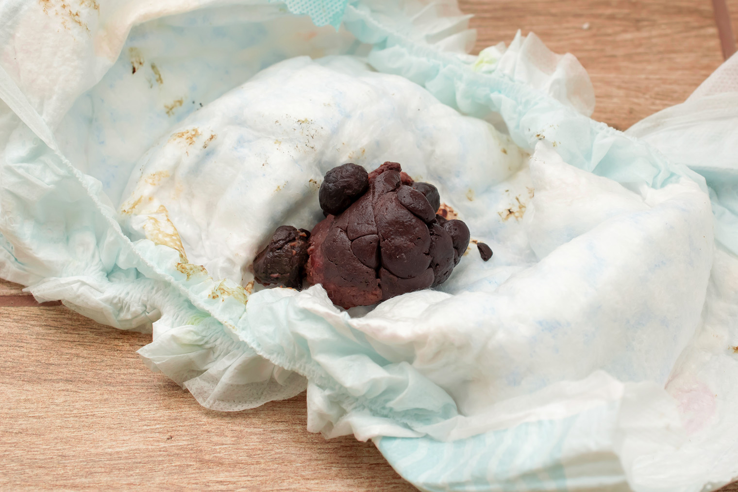 Стул может иметь разные оттенки — от ярко-красного до фиолетового — в зависимости от того, что съел ребенок. Чаще он похож на свекольное пюре. © Remigiusz Gora / Shutterstock / FOTODOM