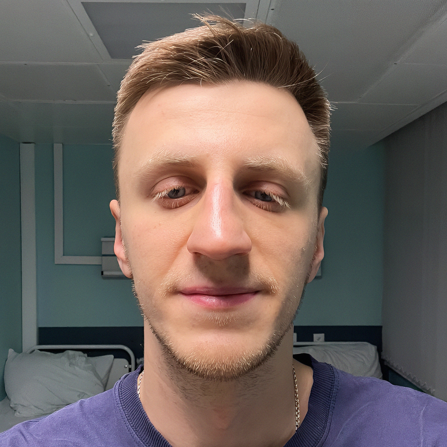 На следующий день, когда сняли тампоны