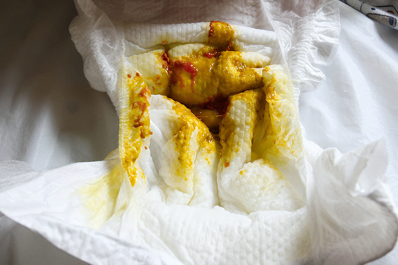 Прожилки крови могут появиться на фоне стула обычного цвета — желтого или светло-коричневого. © Katarzyna Uroda / Shutterstock / FOTODOM