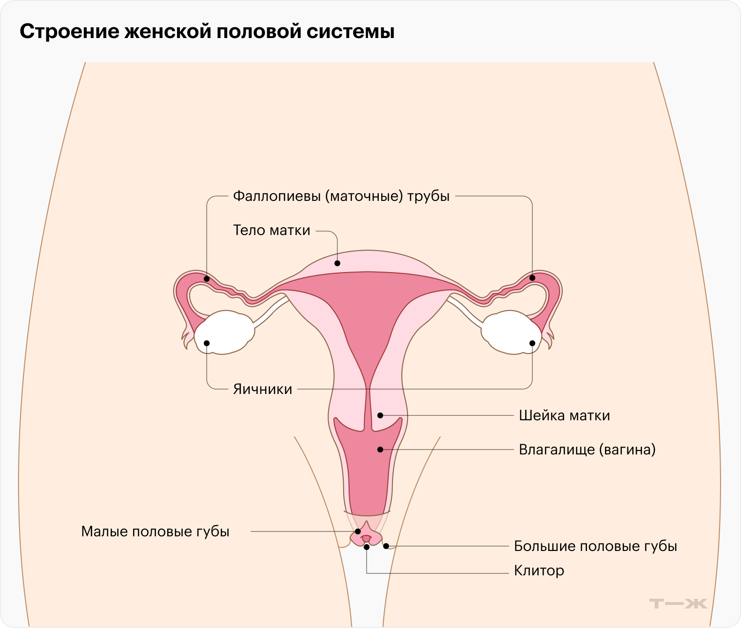 Во время операции по стерилизации маточные трубы или удаляют полностью, или блокируют так, чтобы по ним не могла пройти яйцеклетка