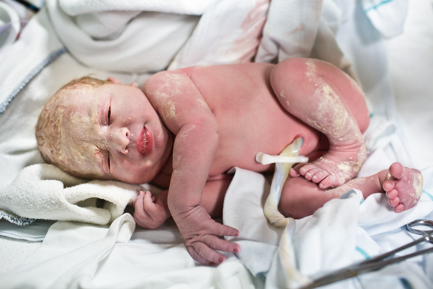 Сразу после рождения тело ребенка частично покрывает первородная смазка, которая защищает чувствительную кожу. Маме не нужно ничего с ней делать: некоторая часть впитается сама, а остальное сотрудники роддома смоют при купании. Фотография: Noctiluxx / Getty