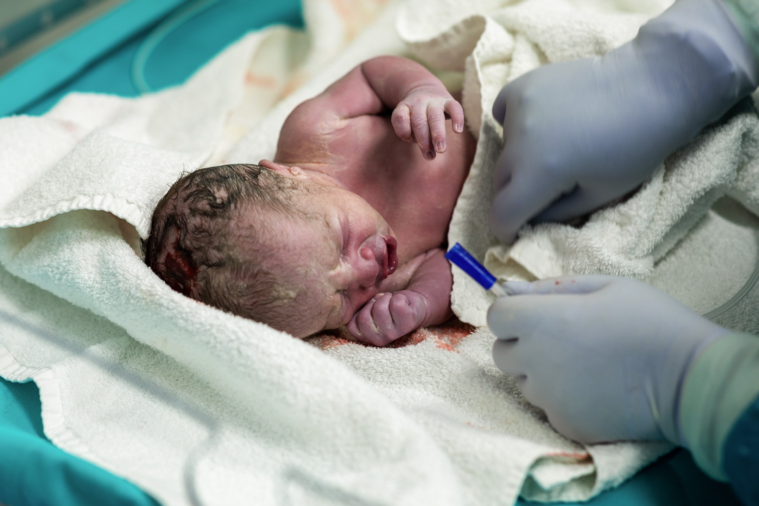 Кожа новорожденного может быть сине⁠-⁠фиолетового оттенка — по всему телу или на отдельных участках, например только на ногах или голове. Фотография: bymuratdeniz / Getty