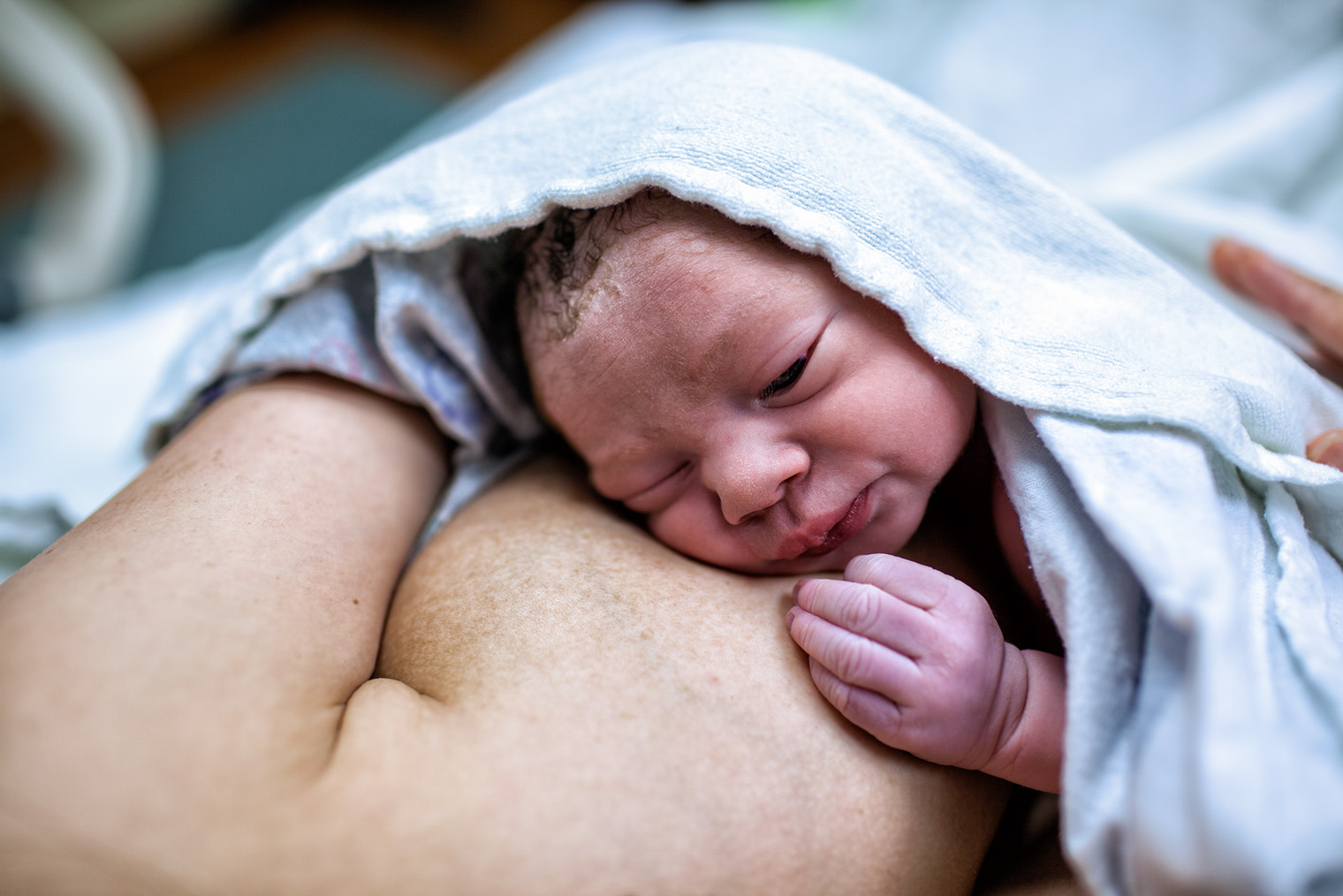 В первые минуты после рождения этому малышу удалось приоткрыть один глаз. Бывает, что из⁠-⁠за отеков век ребенок не может открыть глаза в течение суток. Фотография: Enzo Nguyen@Tercer Ojo Photography / iStock