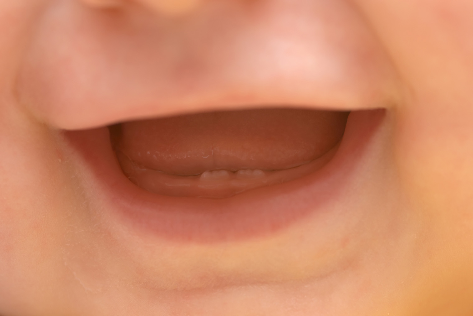 Иногда первые зубы прорезываются сразу по два и выглядят как ребристые полоски. Фотография: AlesVeluscek / iStock