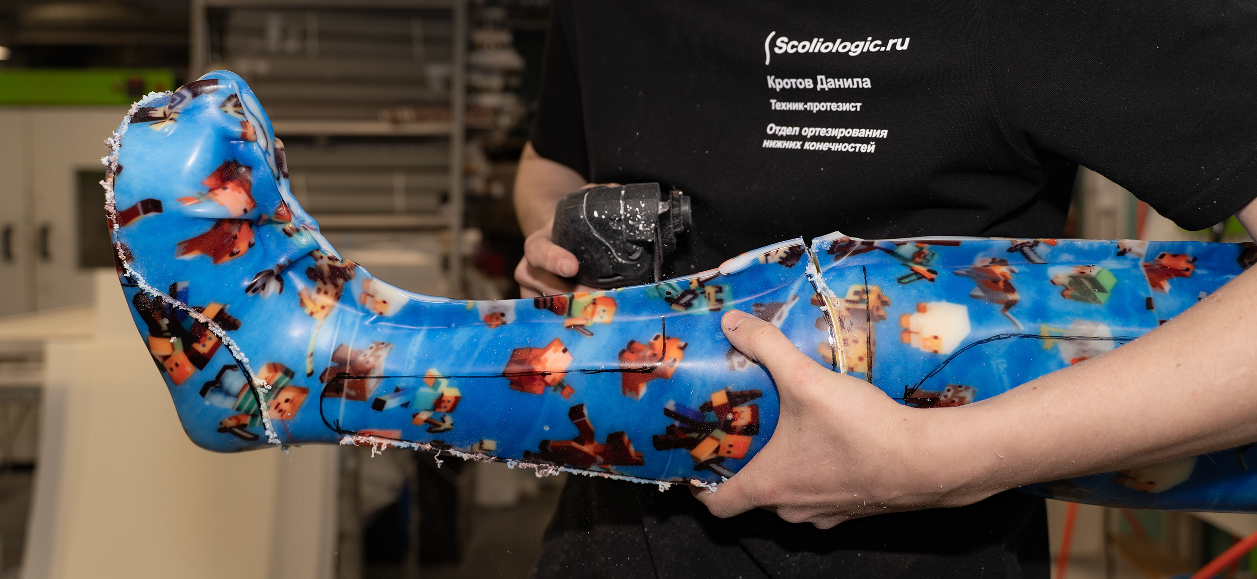 «Так никто не делал»: как два врача построили бизнес на протезах с оборотом 1,5 млрд рублей