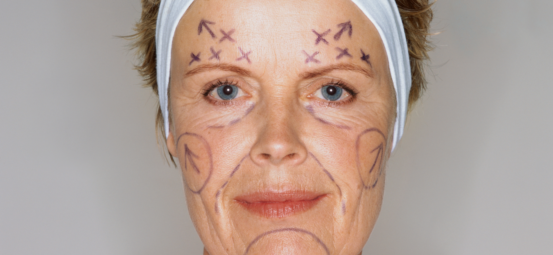 «Лицо становится будто отфотошоп­ленным»: 7 эффек­тивных омола­жи­вающих процедур