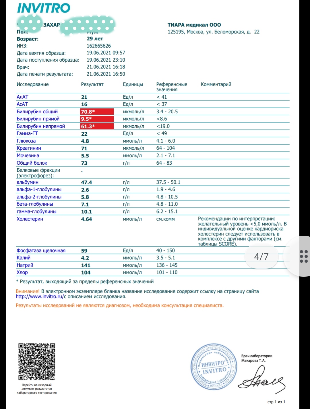 Анализ на гамма-глутамилтранспептидаза (ГГТ) в Запорожье